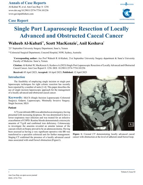 (PDF) Single Port Laparoscopic Resection of Locally Advanced and Obstructed Caecal Cancer