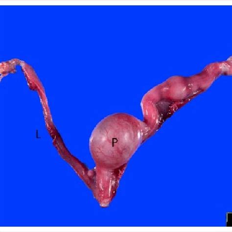 (PDF) Uterus unicornis and pregnancy in two feline littermates