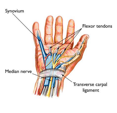 How To Tell If You Have Carpal Tunnel Syndrome And What You Can Do To Treat It