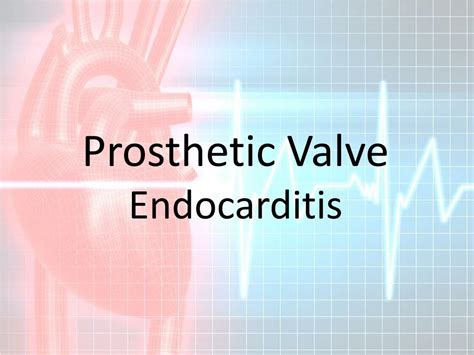 PPT - prosthetic heart valves PowerPoint Presentation, free download ...