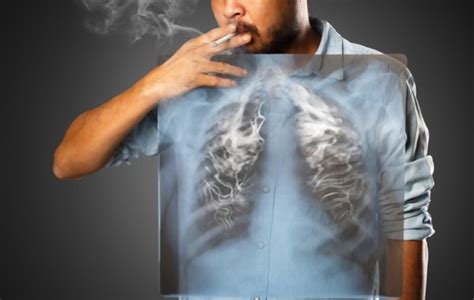 SMOKING AND LUNG CANCER – Kmh Health blog