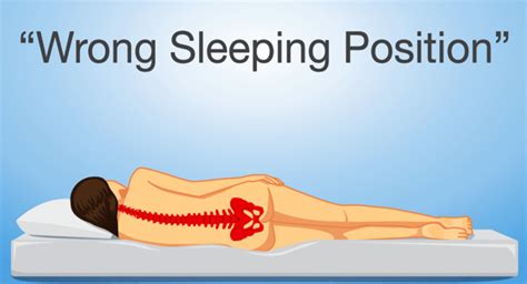 Best Sleeping Position For Sciatica - change comin