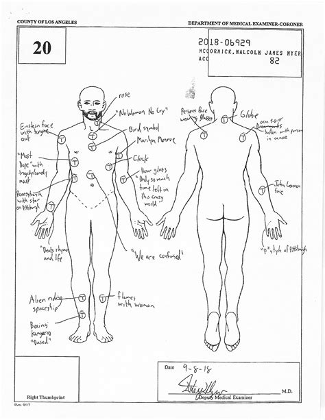 Malcom McCormick - Full Autopsy Report : r/MacMiller