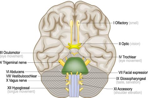 MRI Confirmed Bell's Palsy Presenting with Multiple Cranial Nerve Involvement EMRA