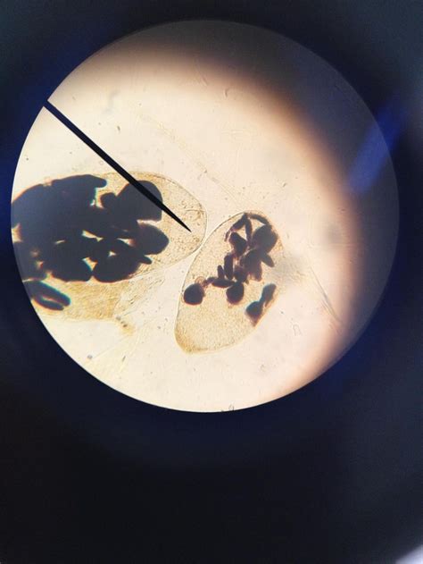 Banana cell stained with iodine to see starch grains & nucleus. Photo taken by @Bio_Joe by ...