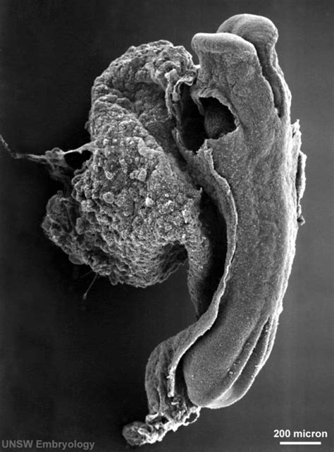 Ectoderm - Embryology