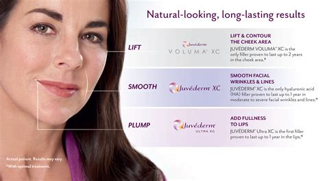 Juvederm Voluma Lips Review | Lipstutorial.org