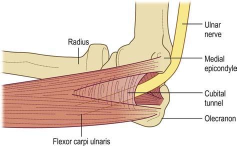 Ulnar Neuropathy at the Elbow | Neupsy Key