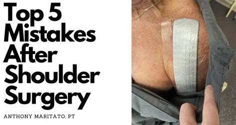 5 Mistakes After Rotator Cuff Surgery