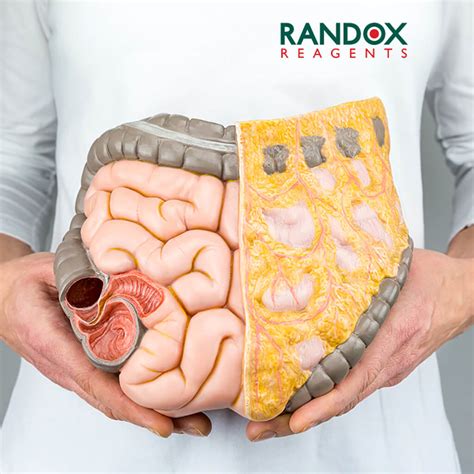 What is Visceral Fat? - Randox Laboratories