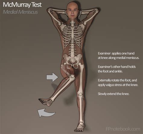 McMurray Test