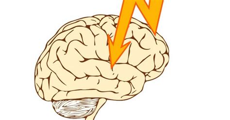 Jacksonian seizure: what it is, symptoms, and how it evolves.