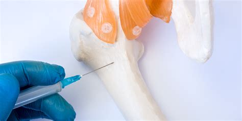 Bone Marrow Biopsy: What is it and What Can it Identify?