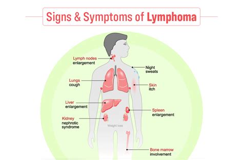 Signs and symptoms of Lymphoma