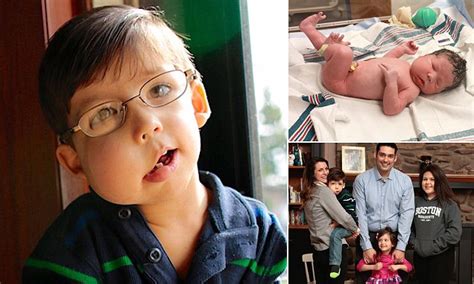 New York boy born with severe genetic mutation is thriving | Daily Mail Online