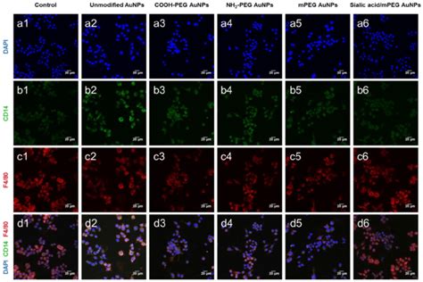 Representative confocal microscopy images of macrophage markers (CD14 ...