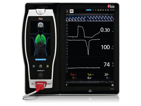 Masimo - Oxygen Reserve Index (ORi™)