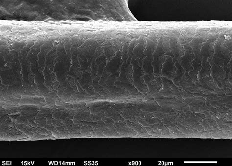 Scanning electron microscopy -Hair examinationsmall (A) and medium... | Download Scientific Diagram