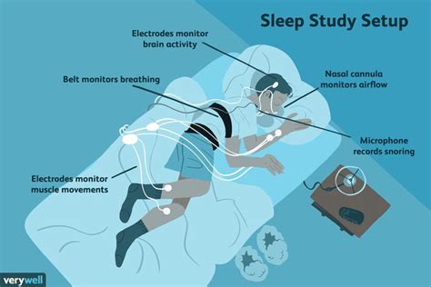 Pin on Sleep Disorders ~ Obstructive Sleep Apnea ( Obstruktiv Søvnapné)