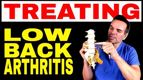 Treating Low Back Arthritis - YouTube