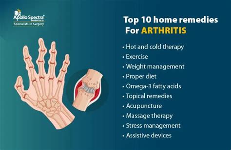 Top 10 Home Remedies for Arthritis