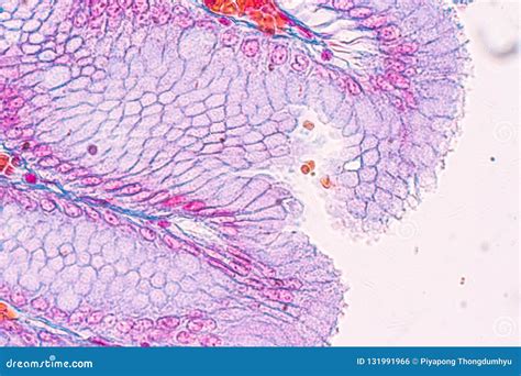 Tissue Of Stomach Under The Microscope For Education. Royalty-Free ...