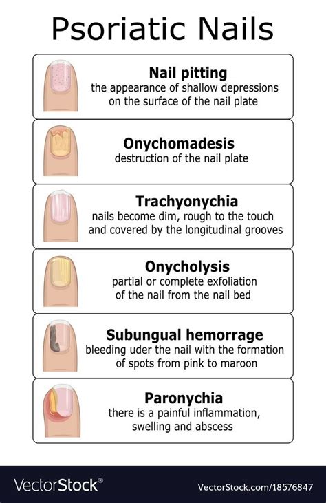 Nail Bed Damage, Nail Diseases And Disorders, Cosmetology State Board ...