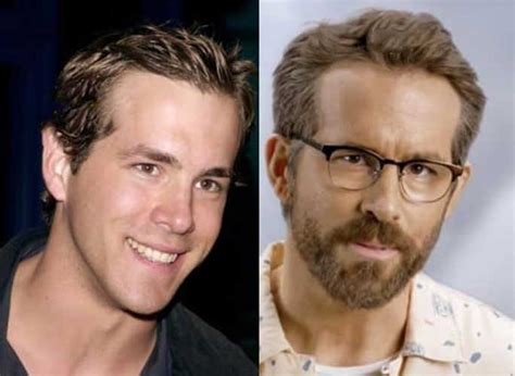 Ryan Reynolds Plastic Surgery: Nose Job, Botox and Hair Transplant