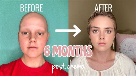 6 Months Post Chemo HAIR GROWTH! - YouTube