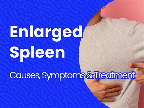 Enlarged Spleen: Causes, Symptoms, and Treatments | Massive Bio