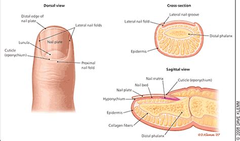 Acute and Chronic Paronychia | AAFP