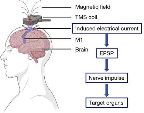 Frontiers | Clinical application of transcranial magnetic stimulation ...