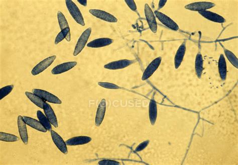 Internal parasites - Stock Photos, Royalty Free Images | Focused