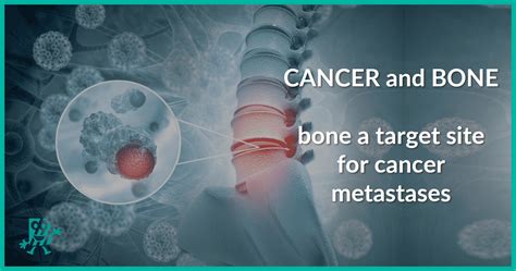 Cancer and Bone | Biomedica