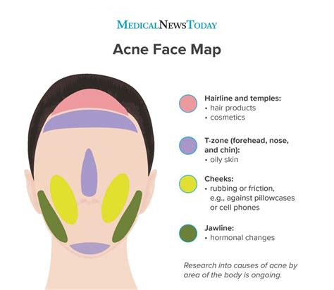 Face mapping comes from ancient Chinese and Ayurvedic medicine. The ...