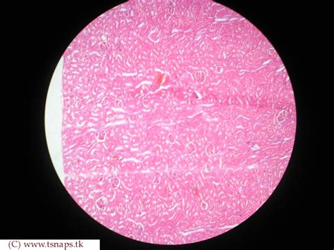 Histology Slides Database: human kidney histology slides