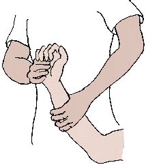 Spasticity in Hemiplegia Physiotherapy Treatment Exercise