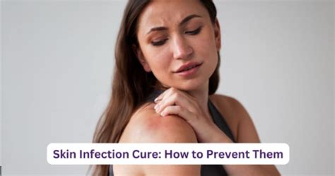 Skin Infection Cure: How To Prevent Them