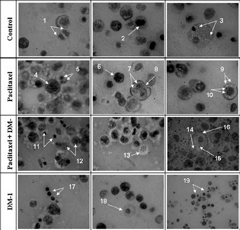 Morphology of EAT cells. The control group showed characteristics such... | Download Scientific ...