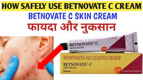 Betnovate c cream || How to use betnovate c skin cream || बेटनोवेट सी के फायदे और नुकसान ...