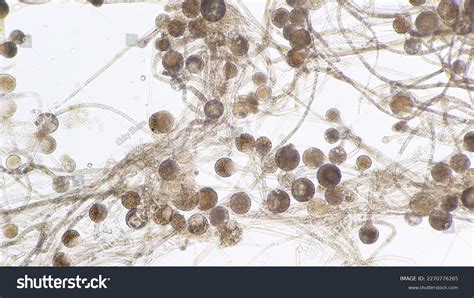 Photo de stock Rhizopus oryzae, un microchampignon hétérotrallique ...