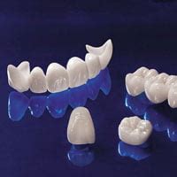 Fixed prosthodontics - Magic Dent