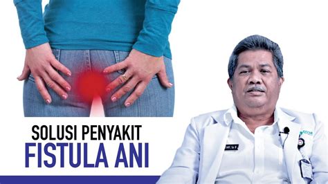 Apakah Penyakit Fistula Ani Menular - Homecare24