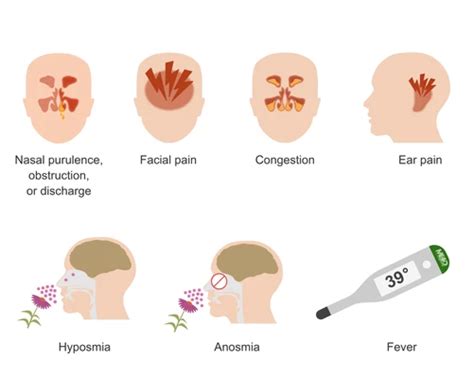 How To Detect Sinus - Effortbroad24