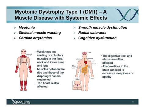 90 best **Bethlem Myopathy - Congenital Muscular Dystrophy images on Pinterest | Chronic fatigue ...