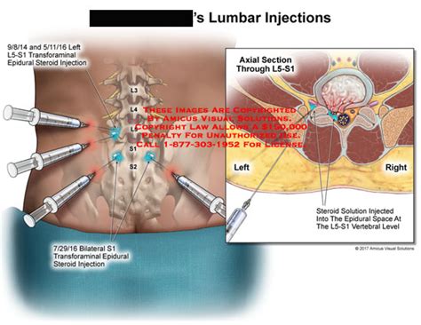 Medical Exhibits, Demonstrative Aids, Illustrations and Models