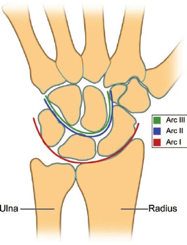 Scaphoid And Lunate Fossa