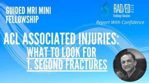 MRI SEGOND FRACTURE: WHAT TO LOOK FOR - Radedasia