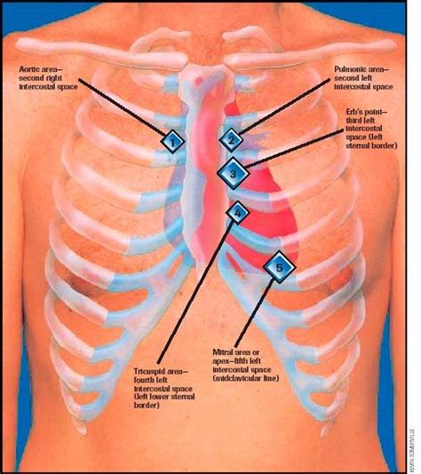 Auscultation - Physiopedia | Nclex, Heart sounds, Nursing school