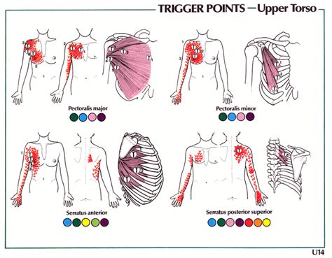 Carpal Tunnel Syndrome | GadiBody.com | Neuromuscular Therapy - Strain ...